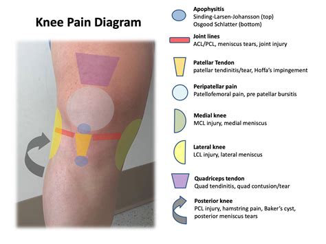 back of leg pain above knee